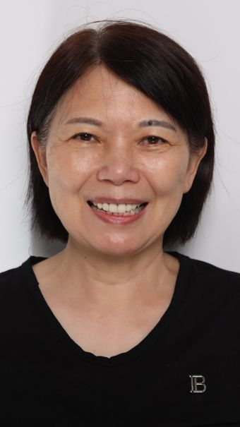 全瓷假牙示意圖