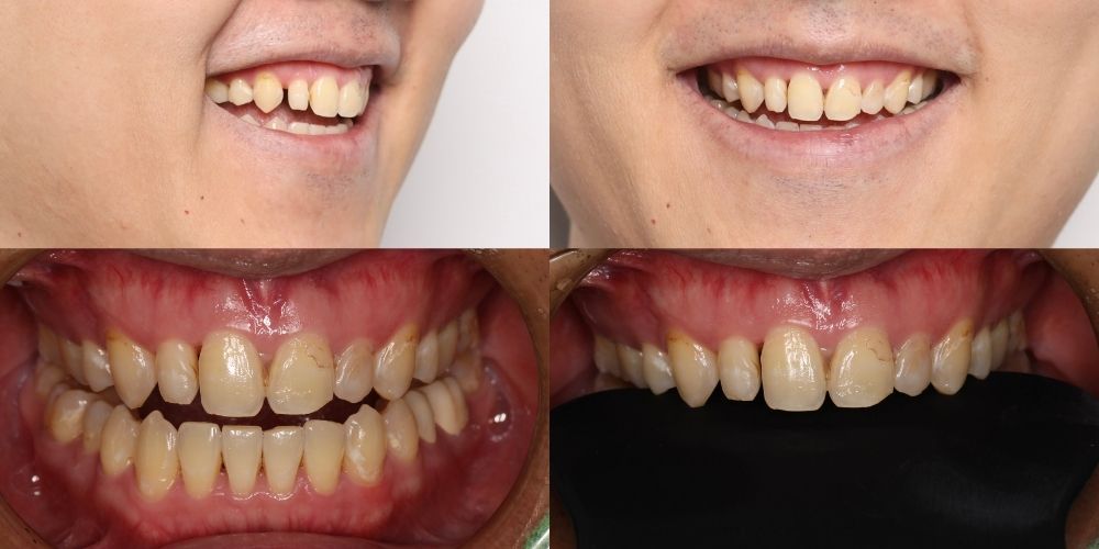 患者背景與狀況