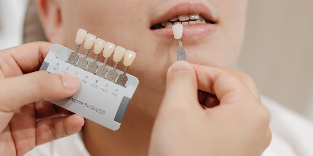 新竹牙齒美白診所推薦:森釉牙醫