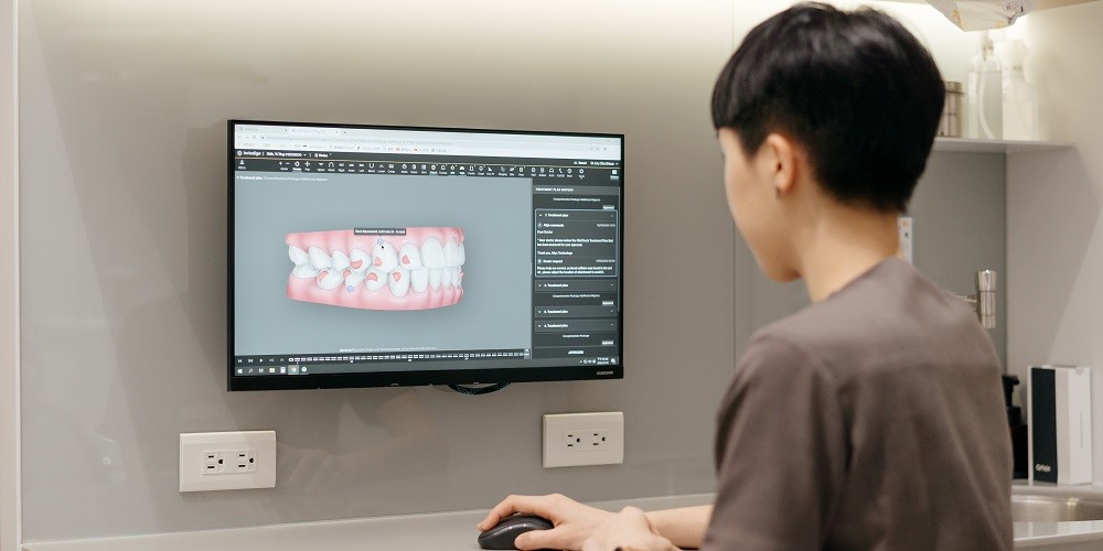 第三步:3D 模擬預覽矯正後齒列效果