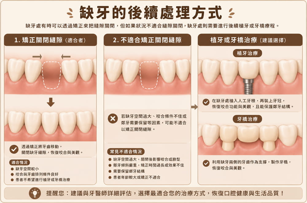 缺牙矯正有哪些方式？