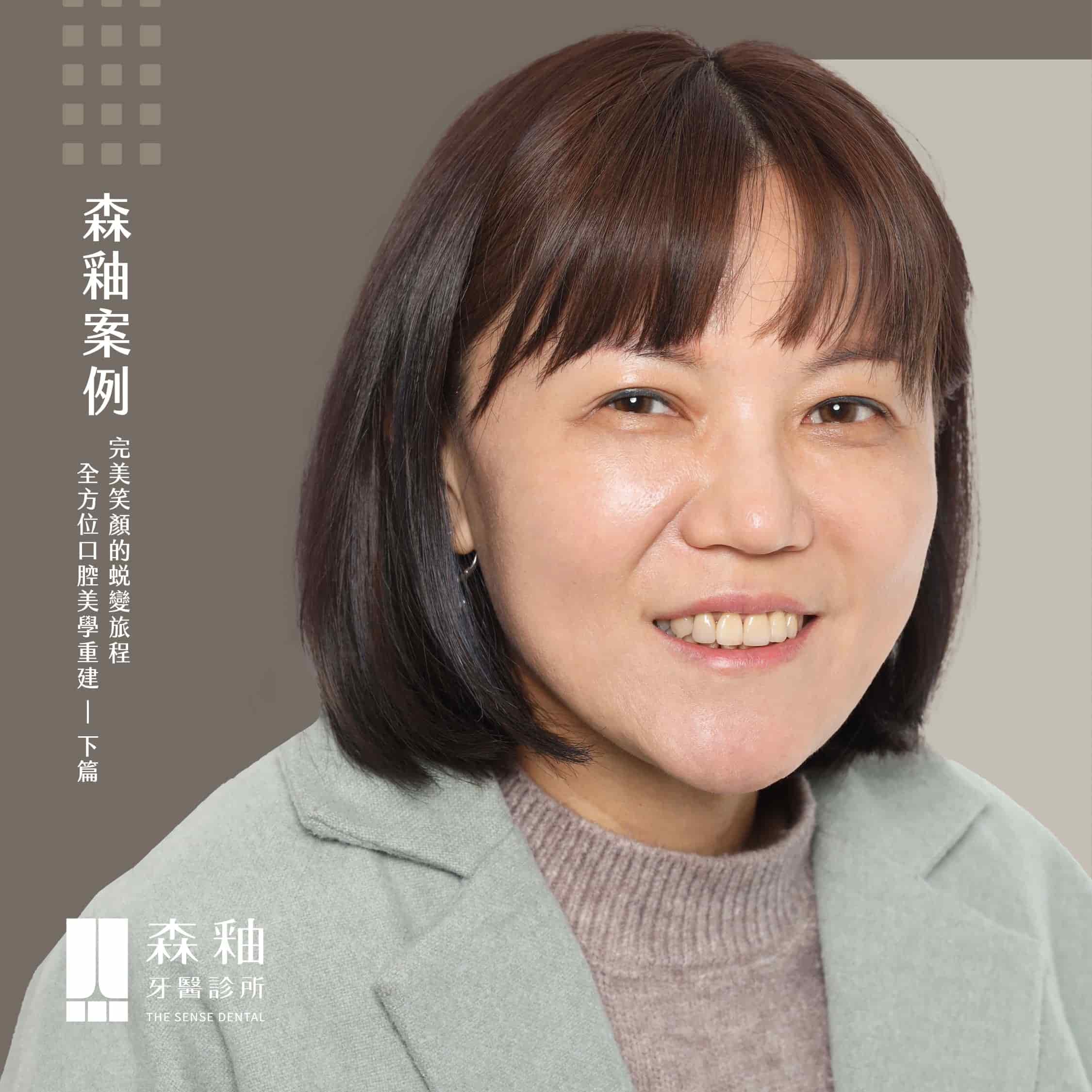 隱適美維持器搭配全口重建