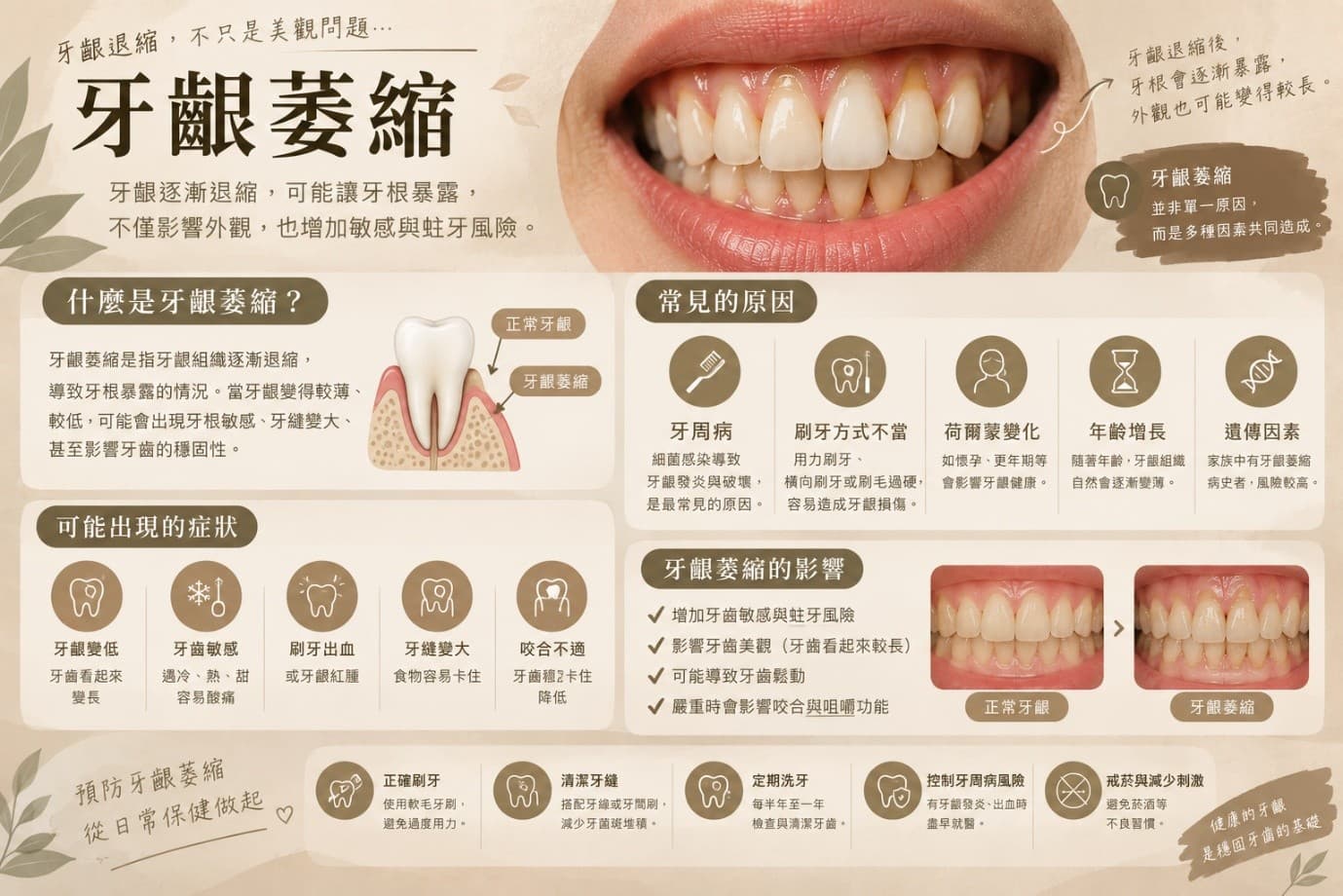 牙齦萎縮是什麼？牙齒變長、牙根外露別忽略