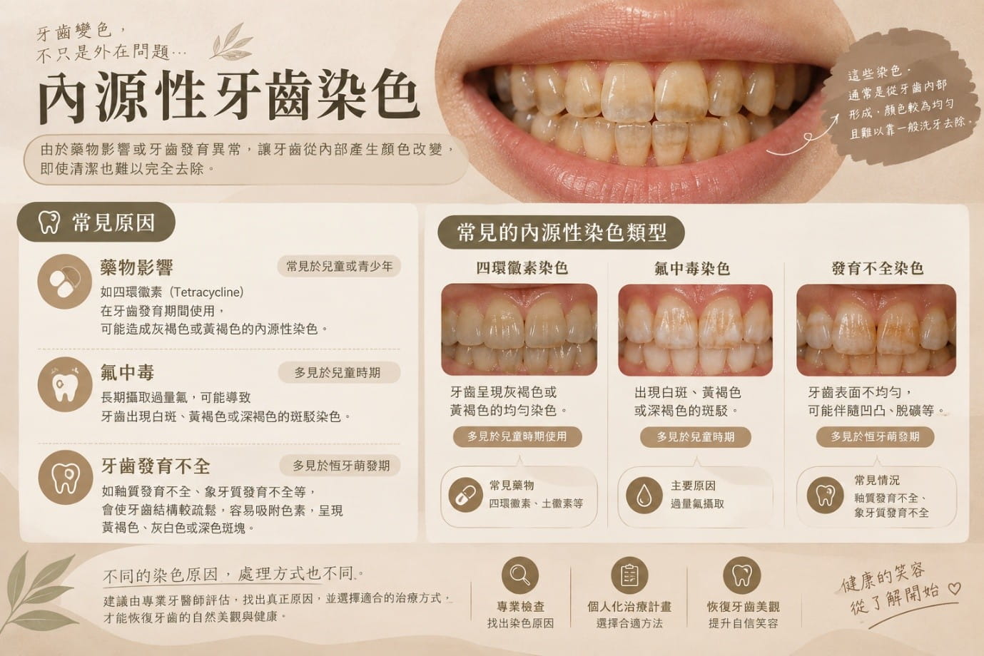 內源性染色：牙齒內部因素造成的色澤改變