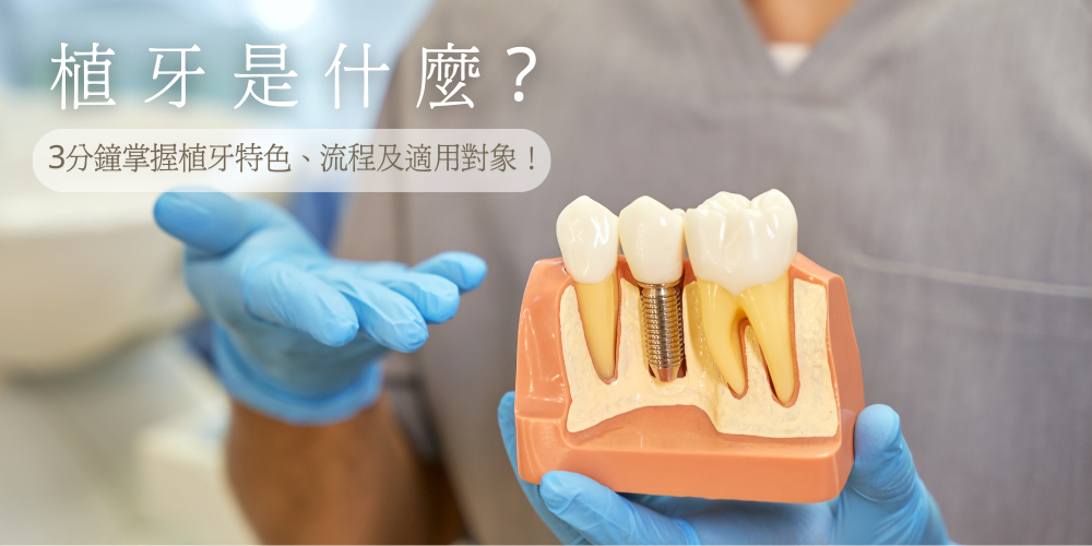 植牙是什麼