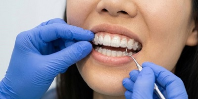 牙齒需要矯正嗎？盤點 7 種需牙齒矯正狀況＋3 種齒列矯正方式(1)