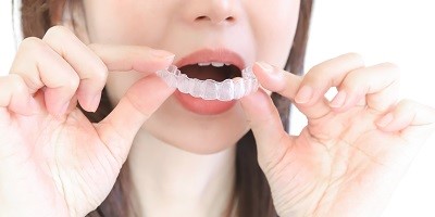 怕痛又愛美？隱形牙套價格、優缺點、費用行情懶人包(1)