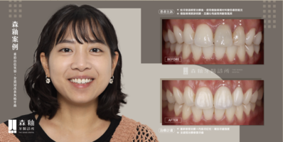 截圖 2026-03-13 上午11.35.48