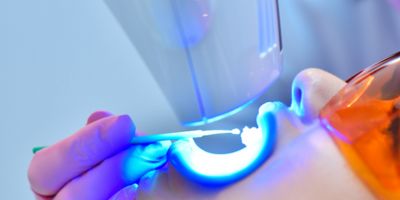 牙齒冷光美白是什麼？5分鐘搞懂流程、價格、優缺點與效果-1