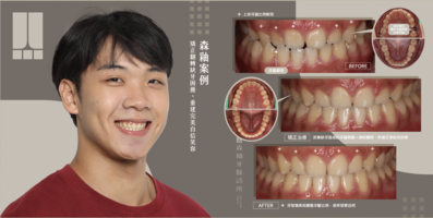 截圖 2026-03-13 下午6.32.43