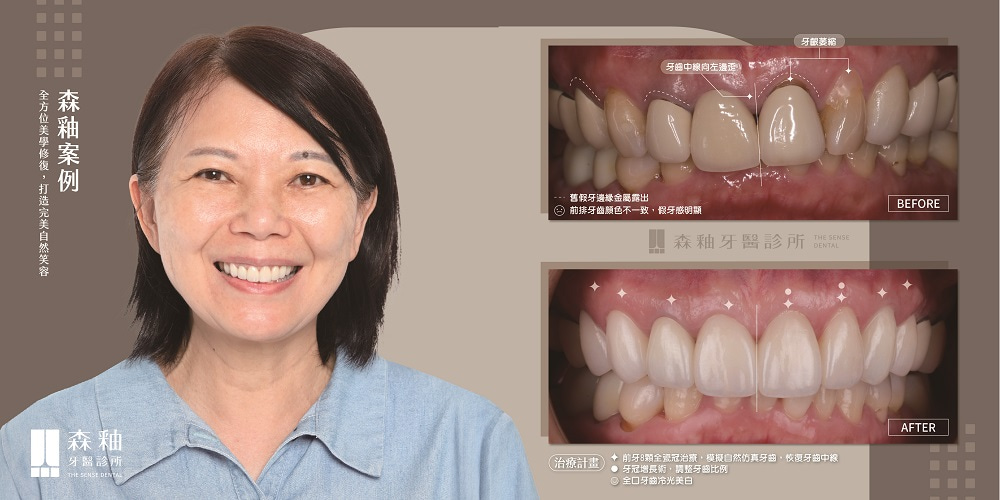 ceramic-advantages-types-case ceramic-advantages-types-case